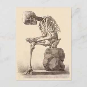 My Feet Are Killing Me Postcard