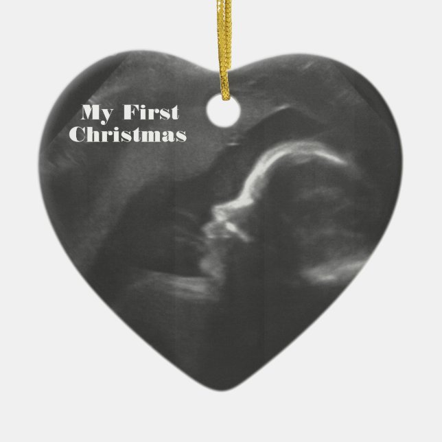 My First Christmas customisable Baby Scan Ceramic Tree Decoration (Front)