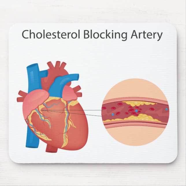 Narrowed blood vessels mouse mat (Front)