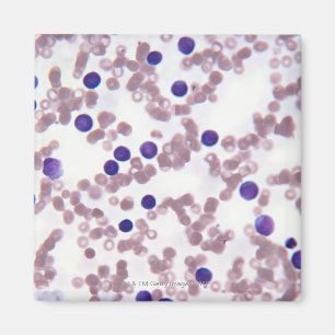 Neoplastic Lymphocyte Cells Magnet