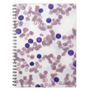 Neoplastic Lymphocyte Cells Notebook