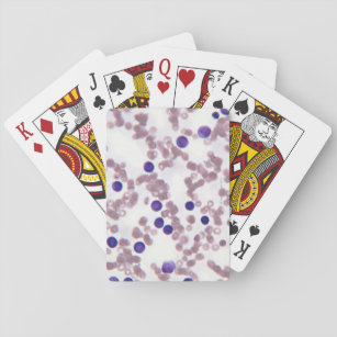 Neoplastic Lymphocyte Cells Playing Cards