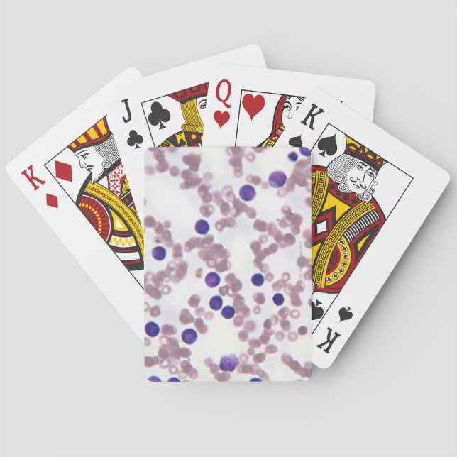 Neoplastic Lymphocyte Cells Playing Cards (Back)