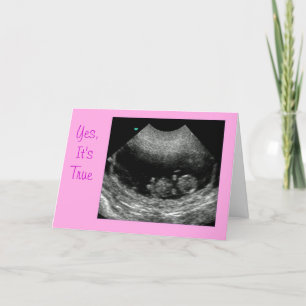 New baby Pink Announcement