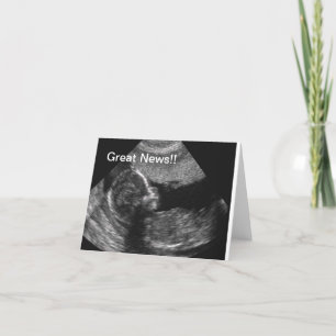 New Baby Ultrasound Announcement