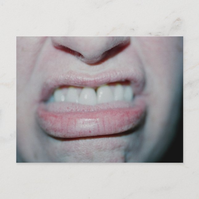 No Smiling Today Postcard (Front)