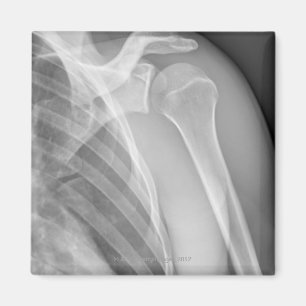 Normal shoulder. X-ray of the healthy left Magnet