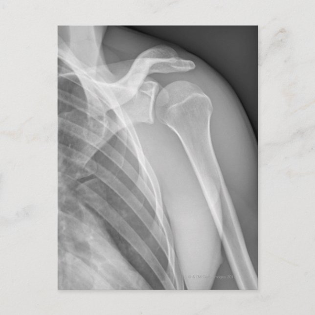 Normal shoulder. X-ray of the healthy left Postcard (Front)