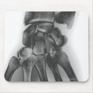 Normal wrist, X-ray Mouse Mat