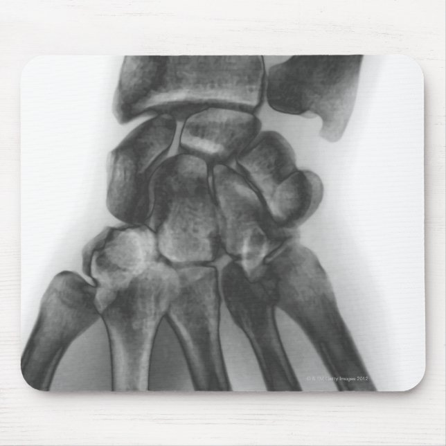 Normal wrist, X-ray Mouse Mat (Front)