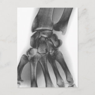 Normal wrist, X-ray Postcard