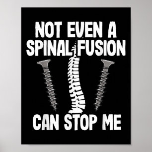 Not Even A Snal Fusion Can Stop Me Back Surgery Re Poster