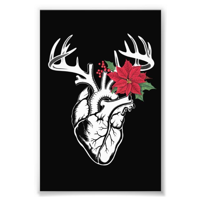 Nurse Heart Anatomy Reindeer Heart Cath Lab RN  Photo Print (Front)