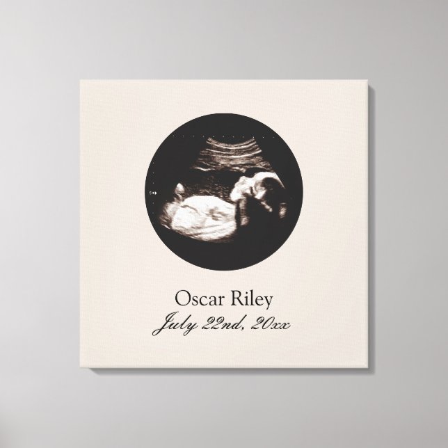 Nursery Art Baby Sonogram Ultrasound Photo Canvas Print (Front)
