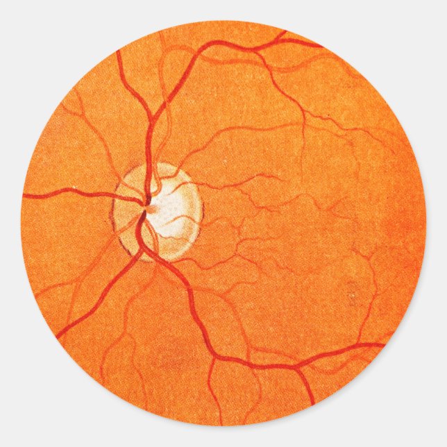 Ophthalmology Optometry Eye Fundus Exam Sticker (Front)