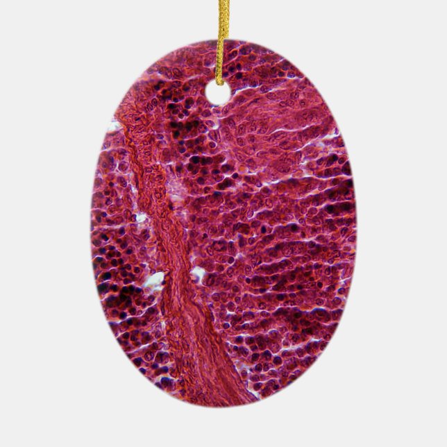 Pancreas Cells under the Microscope Ceramic Tree Decoration (Front)
