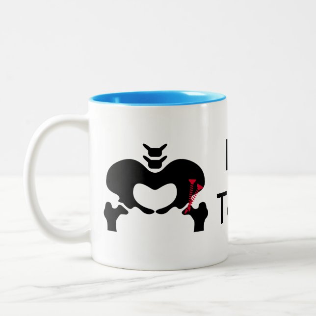 PAO Classic Coffee Mug Peri-acetabular Osteotomy (Left)