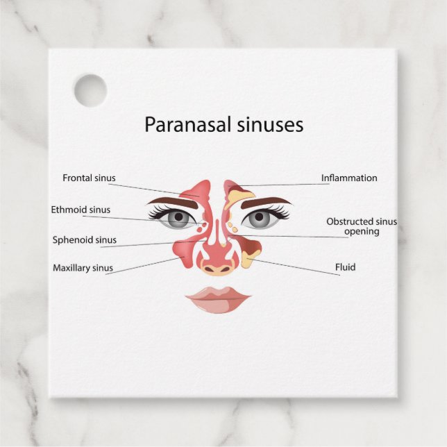 Paranasal sinuses  favour tags (Front)