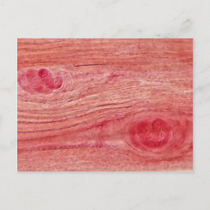 Parasite Trichinella spiralis Postcard