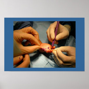 Pediatric Hand Surgery Poster