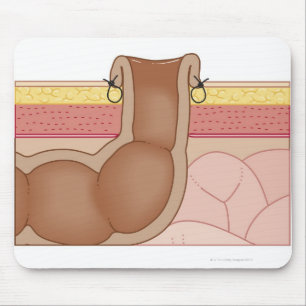 Permanent Colostomy Mouse Mat