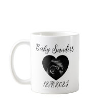 Personalised Baby Sonogram Mug – Custom Ultrasound