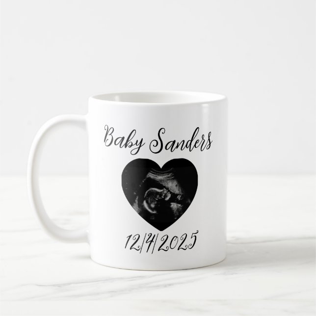 Personalised Baby Sonogram Mug – Custom Ultrasound (Left)