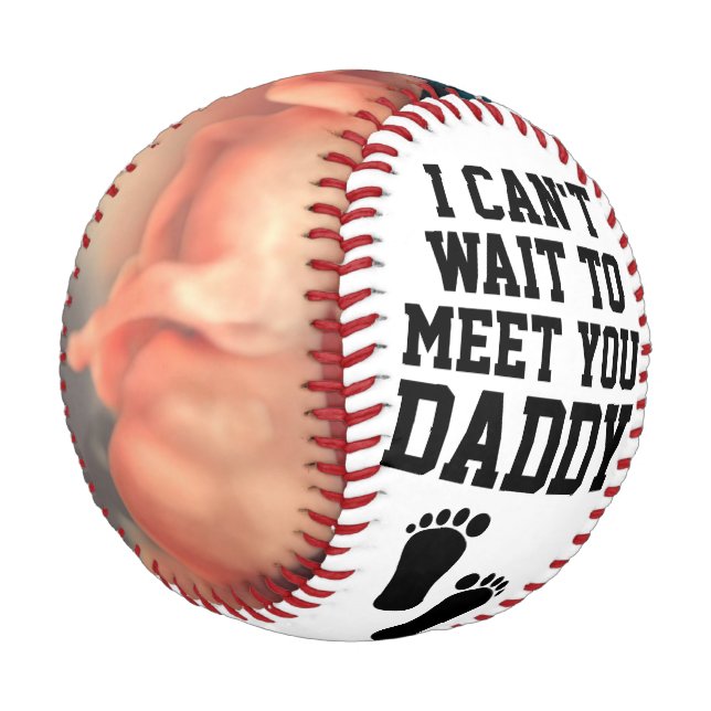 Personalised Sonogram Ultrasound New Daddy Baby Baseball (Angled)