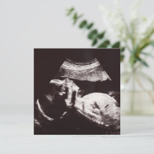 Personalised Ultrasound Picture Baby Shower  Invitation