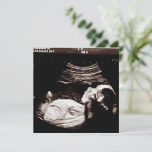 Personalised Ultrasound Picture Baby Shower  Invitation