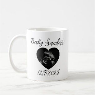 Personalized Baby Sonogram Mug – Custom Ultrasound