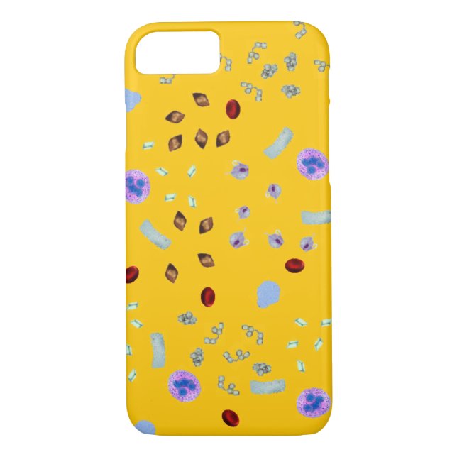 Phone case(many models) - Urine Particulates Case-Mate iPhone Case (Back)