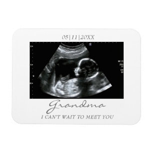 Ultrasound gifts hot sale