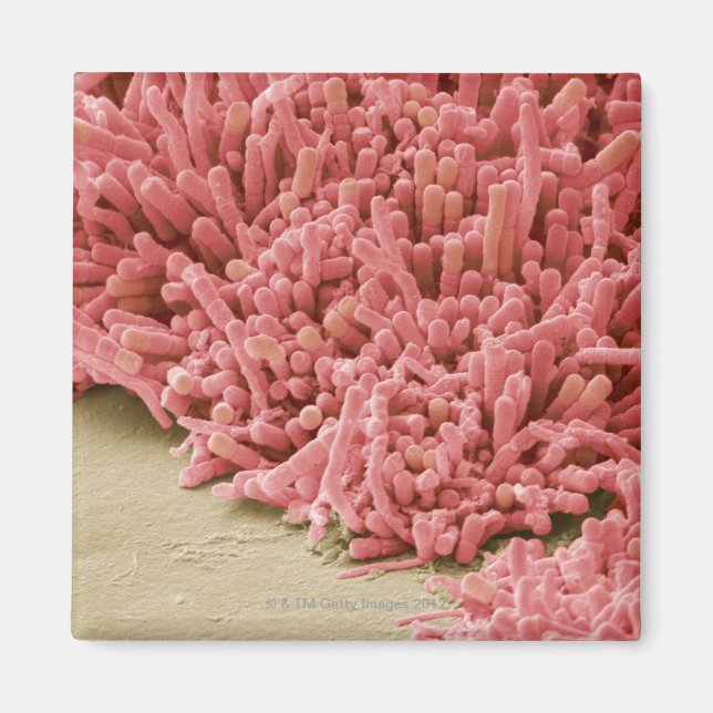 Plaque-forming bacteria, coloured scanning magnet (Front)