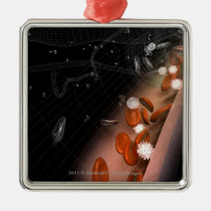 Plaque in the arteries metal tree decoration