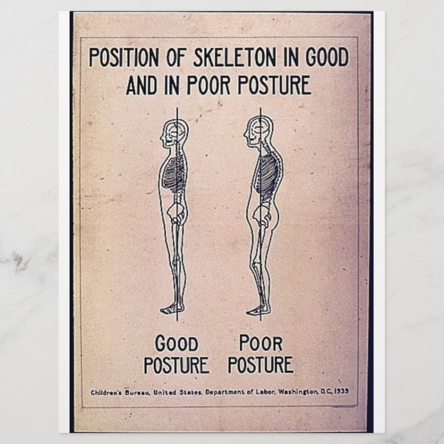Position Of Skeleton In Good And In Poor Posture (Front)