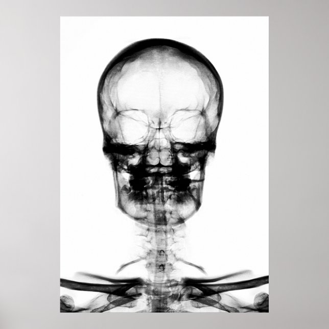 POSTER/PRINT X-RAY VISION SKELETON SKULL - B&W POSTER (Front)