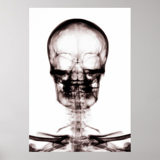 POSTER/PRINT X-RAY VISION SKELETON SKULL ORIG/NEG POSTER