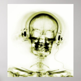 POSTER- X-RAY MUSIC SKELETON WHITE YELLOW POSTER