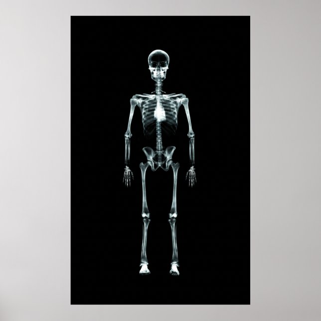 Poster - X-Ray Vision Single Skeleton Original (Front)