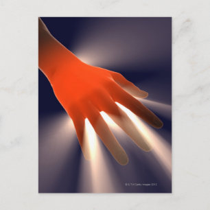 Posterior View of Right Hand. Postcard