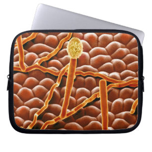 Powdery Mildew Fungus on Poinsettia Laptop Sleeve