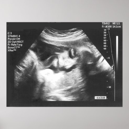 Ultrasound Gifts & Gift Ideas | Zazzle UK