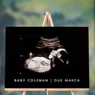 Pregnancy Announcement Baby Shower Sonogram Acrylic Sign