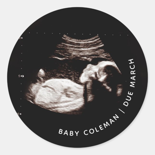 Pregnancy Announcement Baby Sonogram Photo Classic Round Sticker (Front)