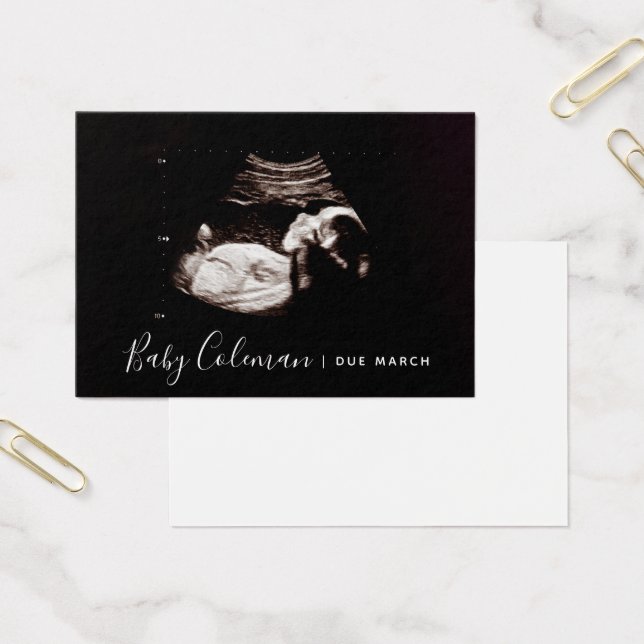 Pregnancy Announcement Sonogram Mini Card (Office)