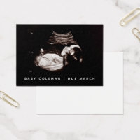 Pregnancy Announcement Sonogram Mini Card Pack