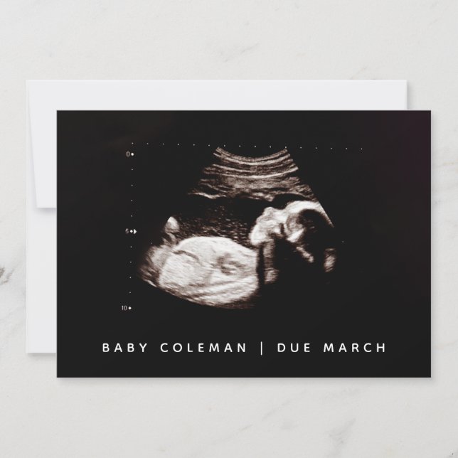 Pregnancy Baby Sonogram Ultrasound Photo Card (Front)