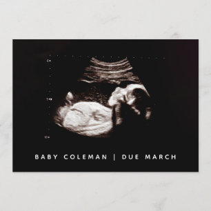 Pregnancy Baby Sonogram Ultrasound Photo Card