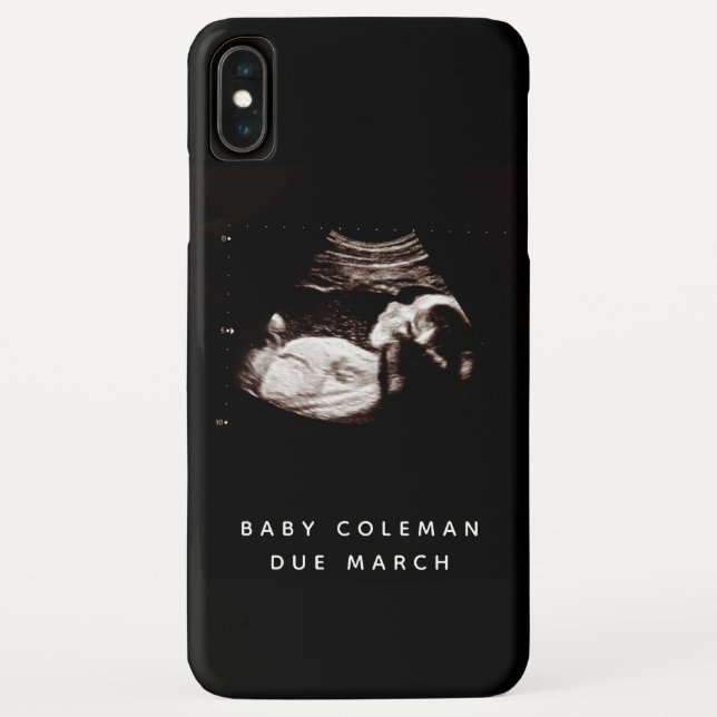 Pregnancy Baby Sonogram Ultrasound Photo Case-Mate iPhone Case (Back)